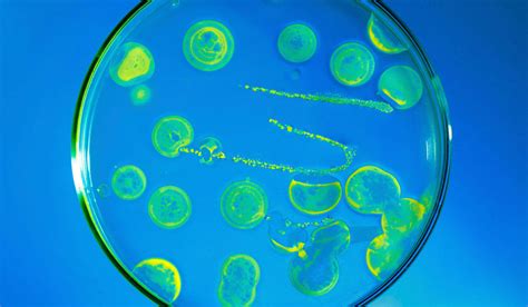 Bildergebnis für candida paragusa