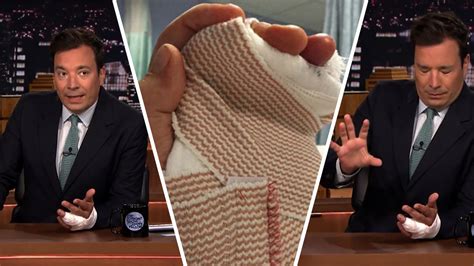 Jimmy Fallon Finally Explains What Happened To His Finger!