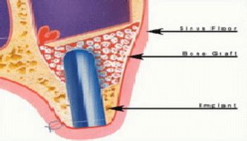 Deep Dental Care - Ahmedabad | Dentist In Ahmedabad, Dental Clinic In ...