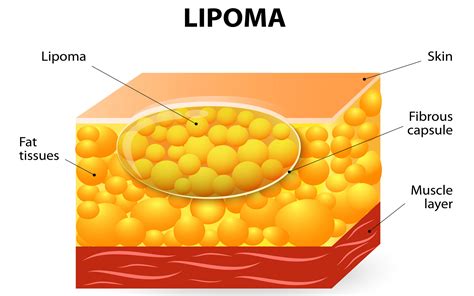 Surgical | Dr. Papantoniou