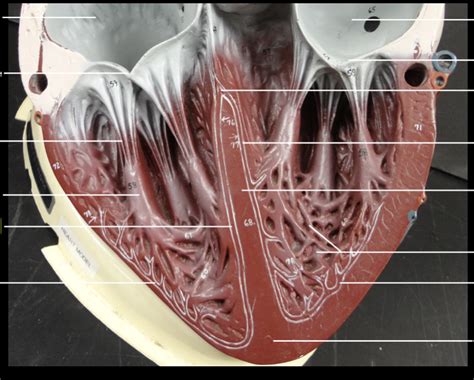 Image result for Cardiac Conduction System Disorders