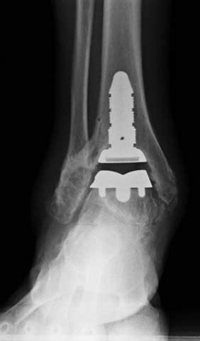 Hardware Monitor Driver 的图像结果