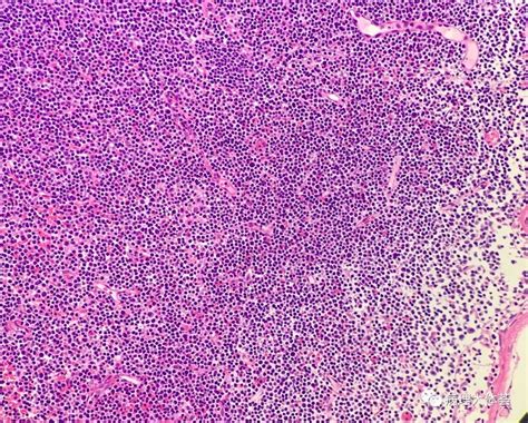 淋巴细胞是什么淋巴细胞是什么意思2022已更新今日热点