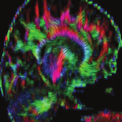 Image result for Line Integral Convolution Image