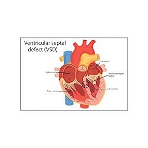 Anne Print Solutions® Eat the rainbow Weight loss chart Poster diagram ...