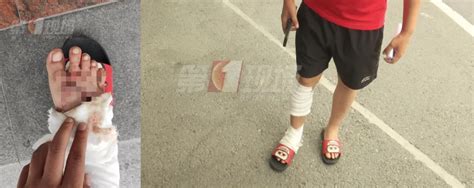 视频：男子路上滑倒摔成三度烧伤！烧碱洗地为何还在使用？_深圳新闻网