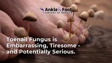 Brown Spots on Feet – Causes, Treatments, and Prevention