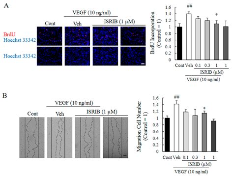 Role of Activating Transcription Factor 4 in Murine Choroidal ...
