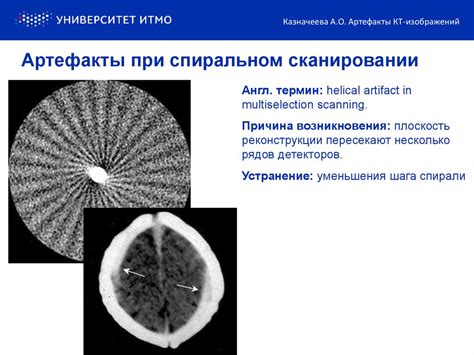 Артефакты КТ-изображений. (Лекция 2) - презентация онлайн