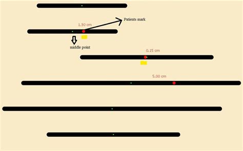 Image result for Line Bisection Test