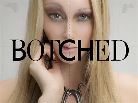 Prime Video: Botched Season 1