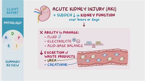 What Does Acute Kidney Damage Mean at Sandra Moody blog