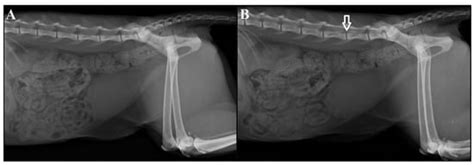 Assessing the Analgesic Efficacy of Lumbosacral Epidural Morphine in ...