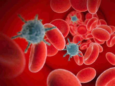 HIV and AIDS opportunistic infections & HIV opportunistic infections guidelines