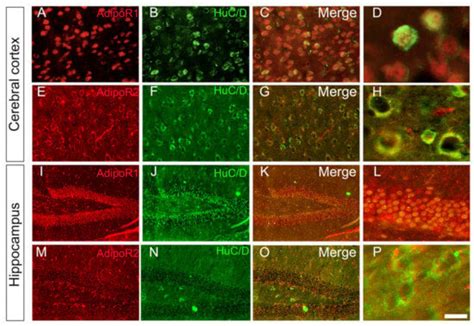 Distribution of Adiponectin Receptors in the Brain of Adult Mouse ...