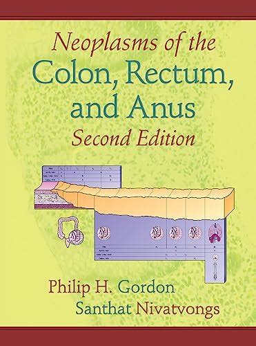 Buy Neoplasms of the Colon, Rectum, and Anus Book Online at Low Prices ...