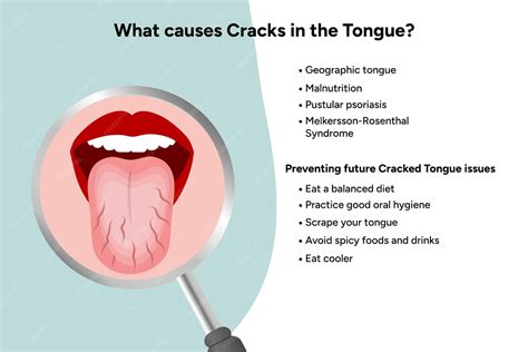 Premium Vector | Causes cracks in tongue medical information