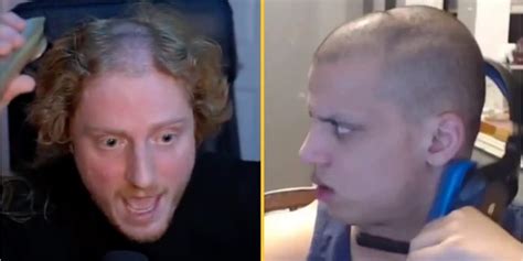 Gamers notice 'dents' in their heads due to headphones - JOE.co.uk