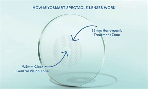 MiYOSMART Glasses Lenses for Myopia Management | Anderson Eye Care