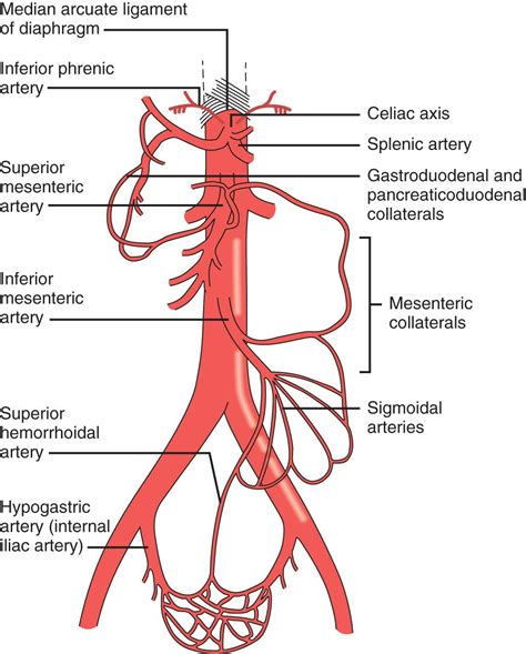Mesenteric Ischemia - Clinical Tree