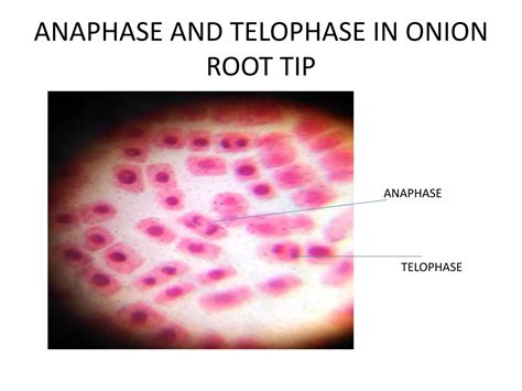Stages Of Mitosis Onion Root Tip