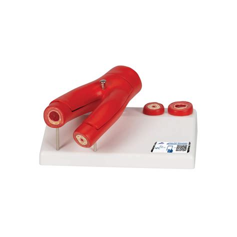 Buy 3B Scientific G40 Human Anatomy - Arteriosclerosis Model with Cross ...