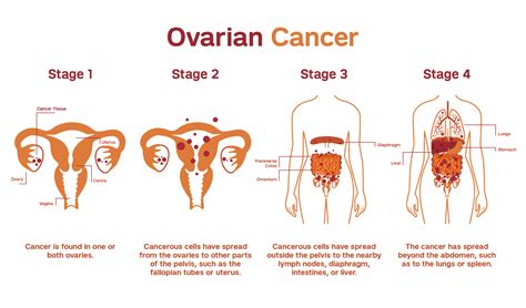 Diagram Of Where Ovaries Are Located