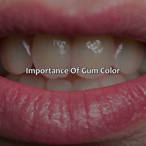 What Color Are Your Gums Supposed To Be - colorscombo.com