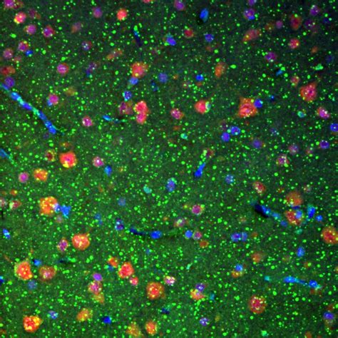 Beta Actin antibody (60008-1-Ig) | Proteintech