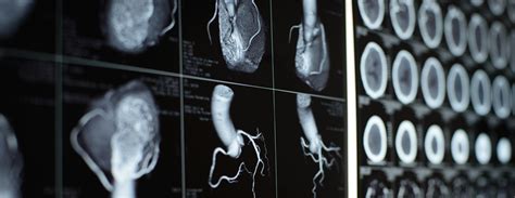 CT of the Gallbladder: Spectrum of Disease | AJR