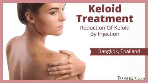 Treatment For Keloids