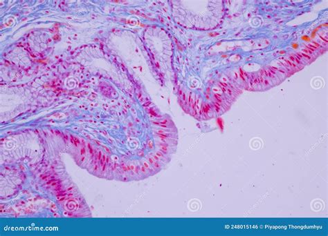 Columnar Epithelium Of Human Gall Bladder Under The Microscope In Lab. Royalty-Free Stock Image ...