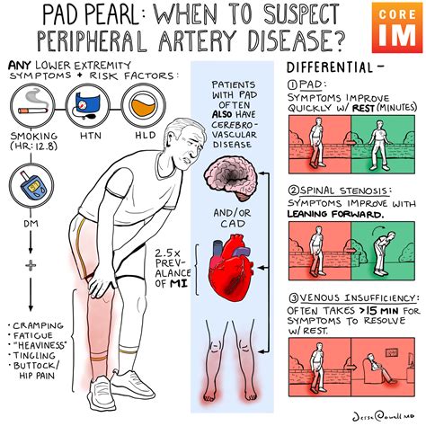 Peripheral Arterial Occlusive Diseases Vs
