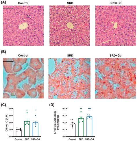 Divergent Hepatic and Adipose Tissue Effects of Kupffer Cell Depletion ...