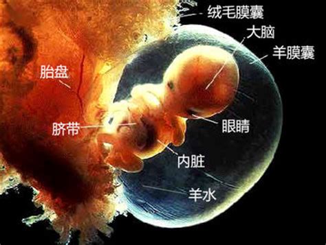 怀孕6个月的准妈妈有两个子宫 羊水破了后才发现_社会_温州网