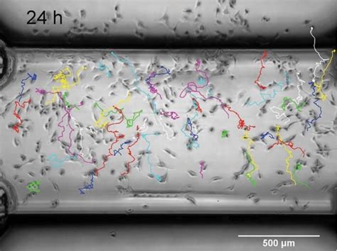 Image result for Manual Tracking ImageJ