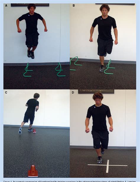 Figure 2 from Rehabilitation of Syndesmotic (High) Ankle Sprains | Semantic Scholar