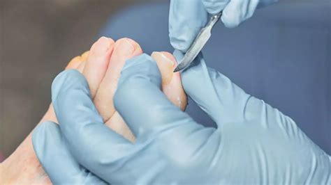 Plastic Surgery Day 2024: How to Choose the Right Plastic Surgeon For ...