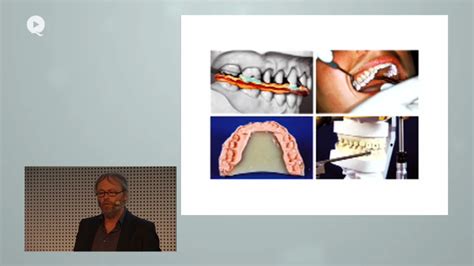 Vestibuloplasty and mucosal graft in implant site re-entry following ...