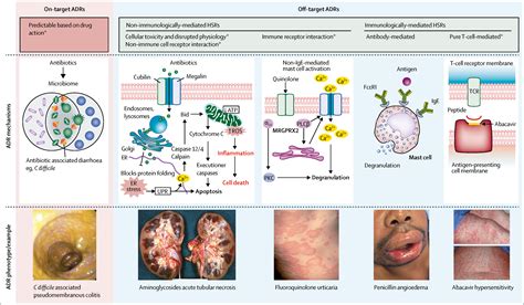 Antibiotic allergy - The Lancet