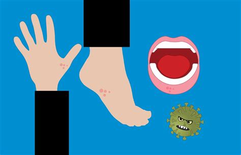 हाथ पर रैशेज (Rashes On Hands) इन कारणों से हो सकते हैं। - हैलो स्वास्थ्य