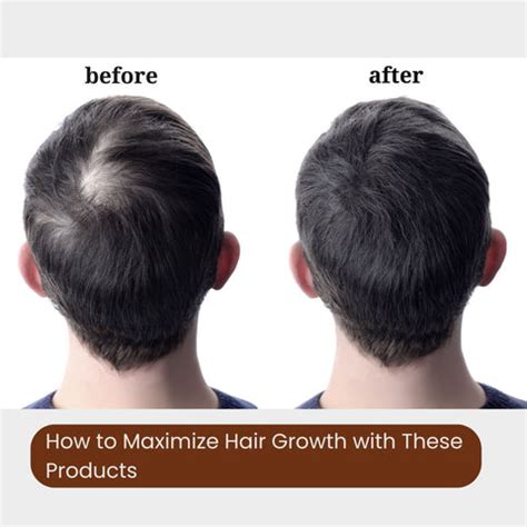 Top 5 Hair Growth Products for Men in 2026 | Clinikally