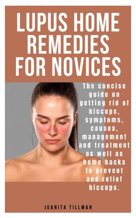 Lupus Home Remedies For Novices The Concise Guide To Lupuc | Desertcart ...