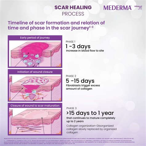 MEDERMA Advanced Plus Scar Gel 5gm Price in India - Buy MEDERMA ...