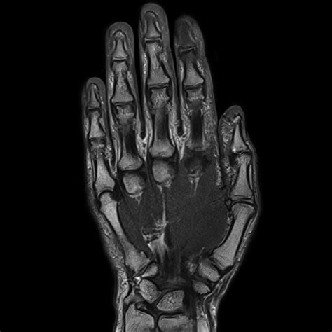 Magnetic Resonance Imaging - Clinical Images