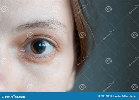 Eye Drops Dilate Pupils at Leo Stonham blog