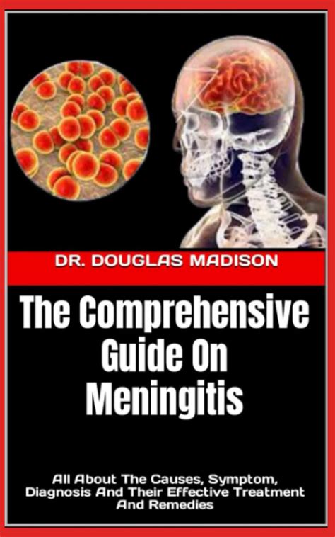 The Comprehensive Guide On Meningitis All About The Causes Symptom ...