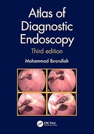 Atlas of Diagnostic Endoscopy, 3E eBook : Ibrarullah, Mohammad: Amazon ...