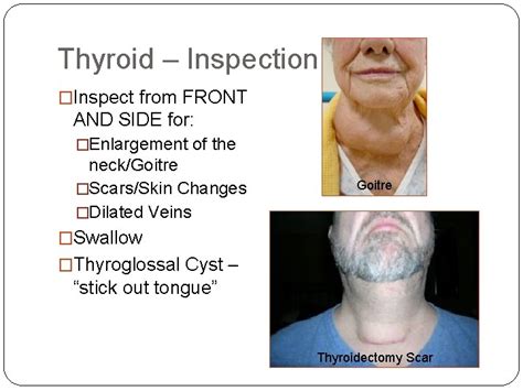 Image result for Thyroid Function Algorithm