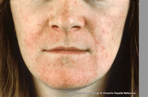 Itchy Skin - A Skin Detective Guide for Adults - Dr Terry Loong